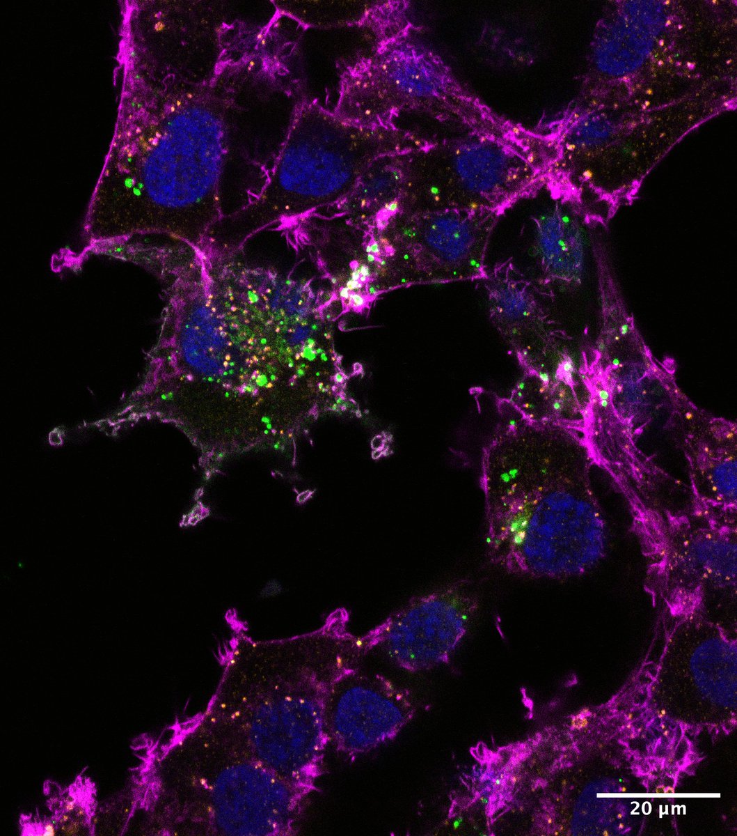 Allen Institute (@alleninstitute) on Twitter photo Extracellular vesicles hold huge promise for therapeutic delivery. 💊🚀
<a href="/KennethWWitwer/">Kenneth W Witwer (he/him)</a> (<a href="/HopkinsMedicine/">Johns Hopkins Medicine</a>), Angela Zivkovic (<a href="/ucdavis/">UC Davis</a>), and Wyatt Vreeland (<a href="/NIST/">National Institute of Standards and Technology</a>) are developing tech to better visualize and track them. #FrontierScience
🔗 alleninstitute.org/division/front… Extracellular vesicles hold huge promise for therapeutic delivery. 💊🚀
<a href="/KennethWWitwer/">Kenneth W Witwer (he/him)</a> (<a href="/HopkinsMedicine/">Johns Hopkins Medicine</a>), Angela Zivkovic (<a href="/ucdavis/">UC Davis</a>), and Wyatt Vreeland (<a href="/NIST/">National Institute of Standards and Technology</a>) are developing tech to better visualize and track them. #FrontierScience
🔗 alleninstitute.org/division/front…