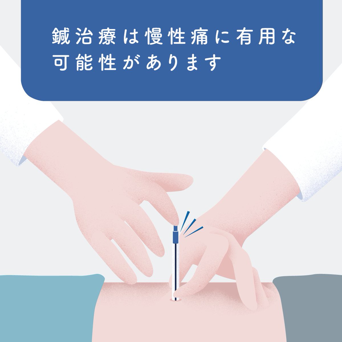 eJIM_PR's tweet image. 鍼治療は、腰痛、頚部痛、変形性関節症などの痛みの緩和に有用な可能性があります。また、筋緊張性頭痛や片頭痛にも効果がある場合があります。

ejim.mhlw.go.jp/pro/overseas/c…
