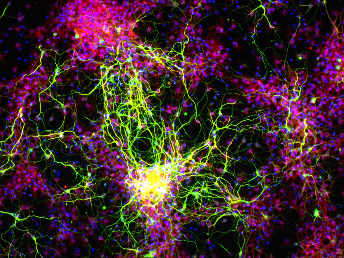 NatEyeInstitute's tweet image. Drumroll, please!! Introducing our #ImageOfTheMonth for August. This photo shows new neurons (green) and their supporting cells, called astrocytes (red), created in a petri dish from stem cells. 

brnw.ch/21wUTEs

#Vision