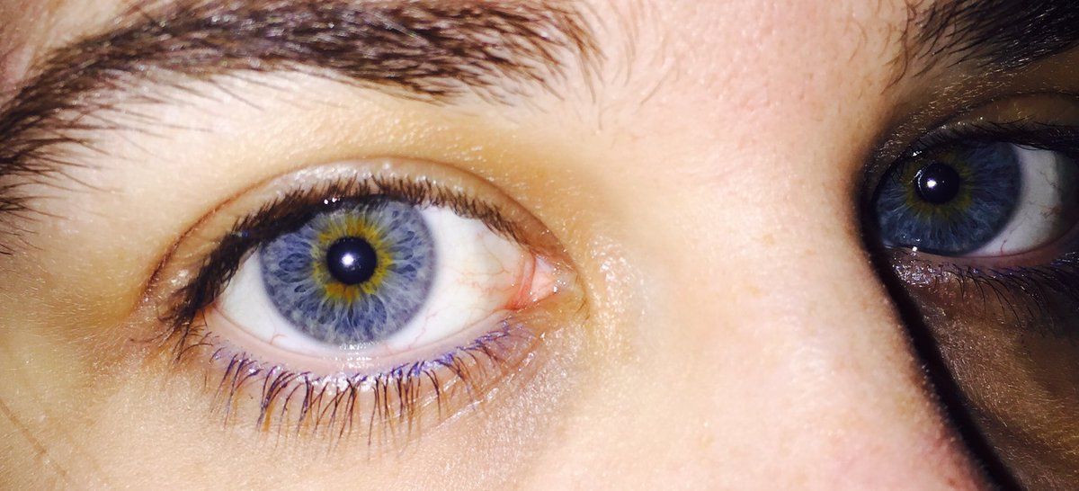 Pon tus ojos y pregunta que animal eres o cuantas horas has dormido