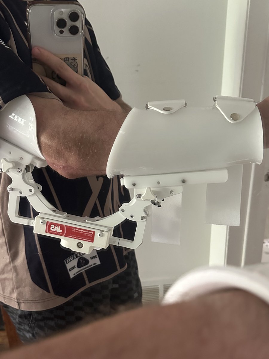 gamer advice: do not, under any circumstances, get ran over by a car and break your elbow