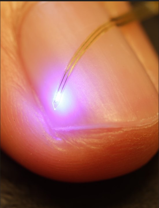 ProfJohnARogers's tweet image. Another collaborative paper from the group published today, titled “Analytical Solutions for Light Propagation of LEDs,” in Proceedings of the National Academy of Sciences (pnas.org/doi/epdf/10.10…). This analytical study, led by our longtime collaborator Prof. Yonggang Huang…