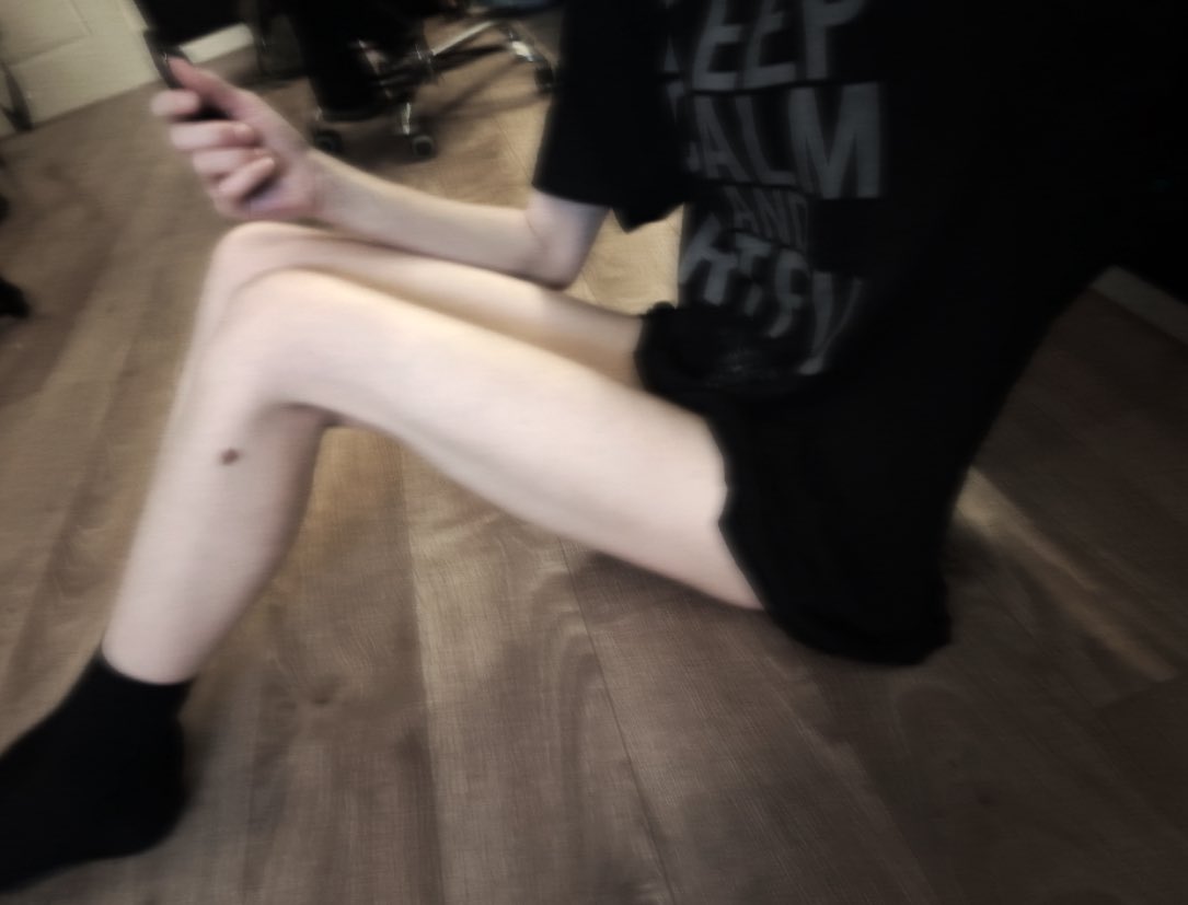 rotten_braiin's tweet photo. I will regret it but 
pls bmi guess im gonna rip my skin off in a moment https://t.co/NEQld0G5LI