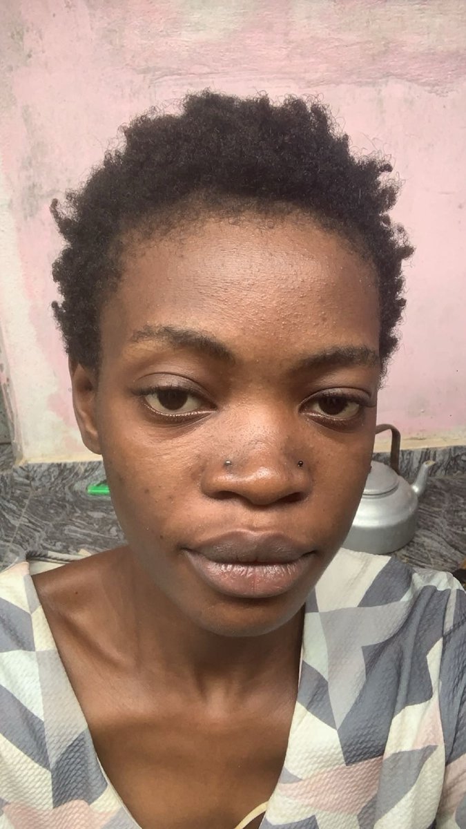 nasashaaaa's tweet photo. Hate to be that guy but this is me when I was battling weed addiction vs now and I chose the most ordinary pic for this. Ngl I love weed, helped me through my toughest times but let’s not deny the damage it causes physically, mentally and emotionally even https://t.co/08Q3IWF0Y6