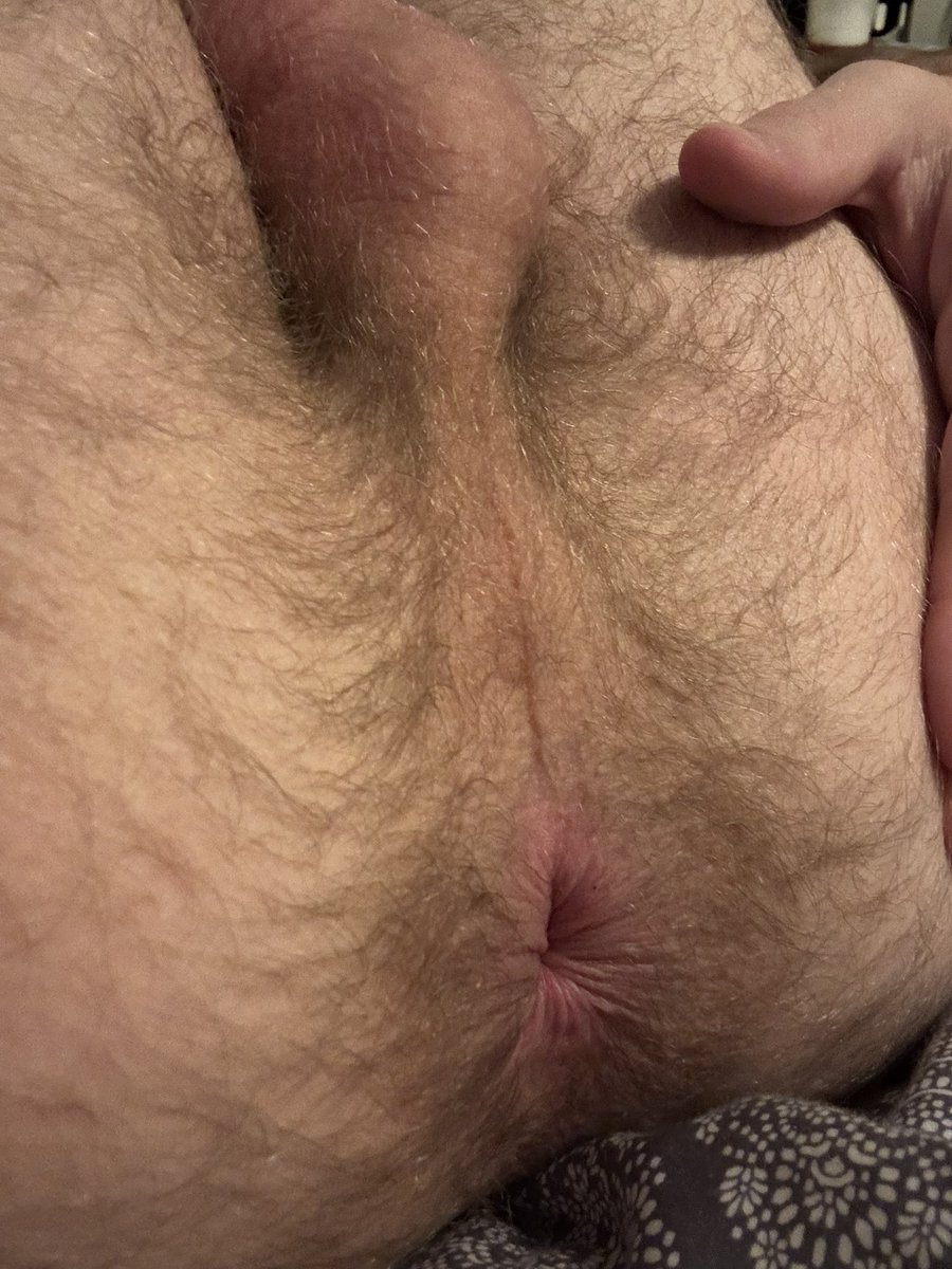 Not sure why that video posted twice, but holy moly I didn’t expect to break 1000 followers overnight. Starting to feel like a minor celebrity 🤩

Enjoy a shitty pic of my tight, post-fisting hole as a celebration 😂