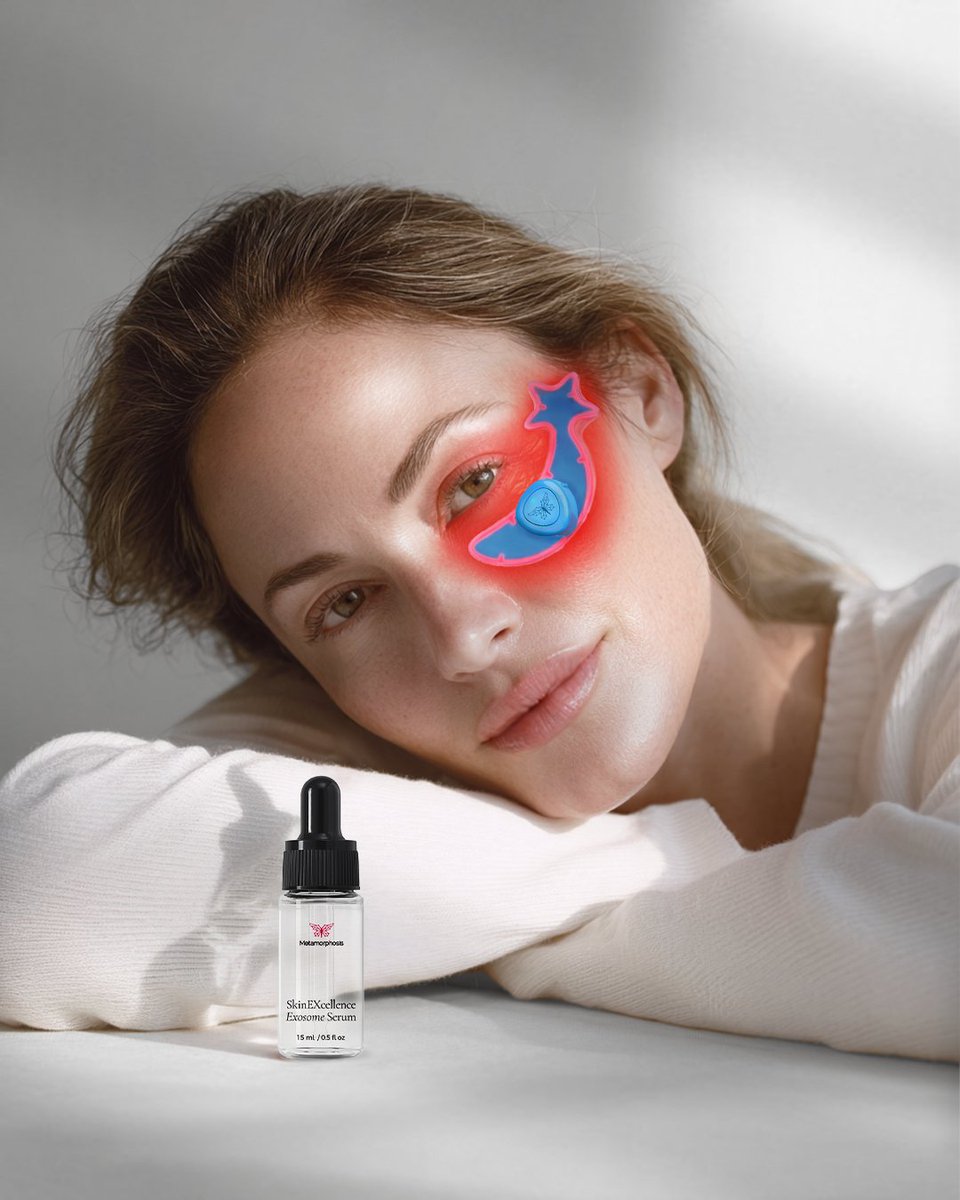 Metalightther's tweet photo. Unlock your ultimate glow! Pair the world's 1st SkinEXcellence Exosome Serum with MagicMoon for revitalized skin and brighter, tighter eyes by boosting collagen and reducing dark circles -> https://t.co/0txRlKzf0x
#SkincareDuo #GlowUp #SkinEXcellence #MagicMoon https://t.co/eNXvocIQwe