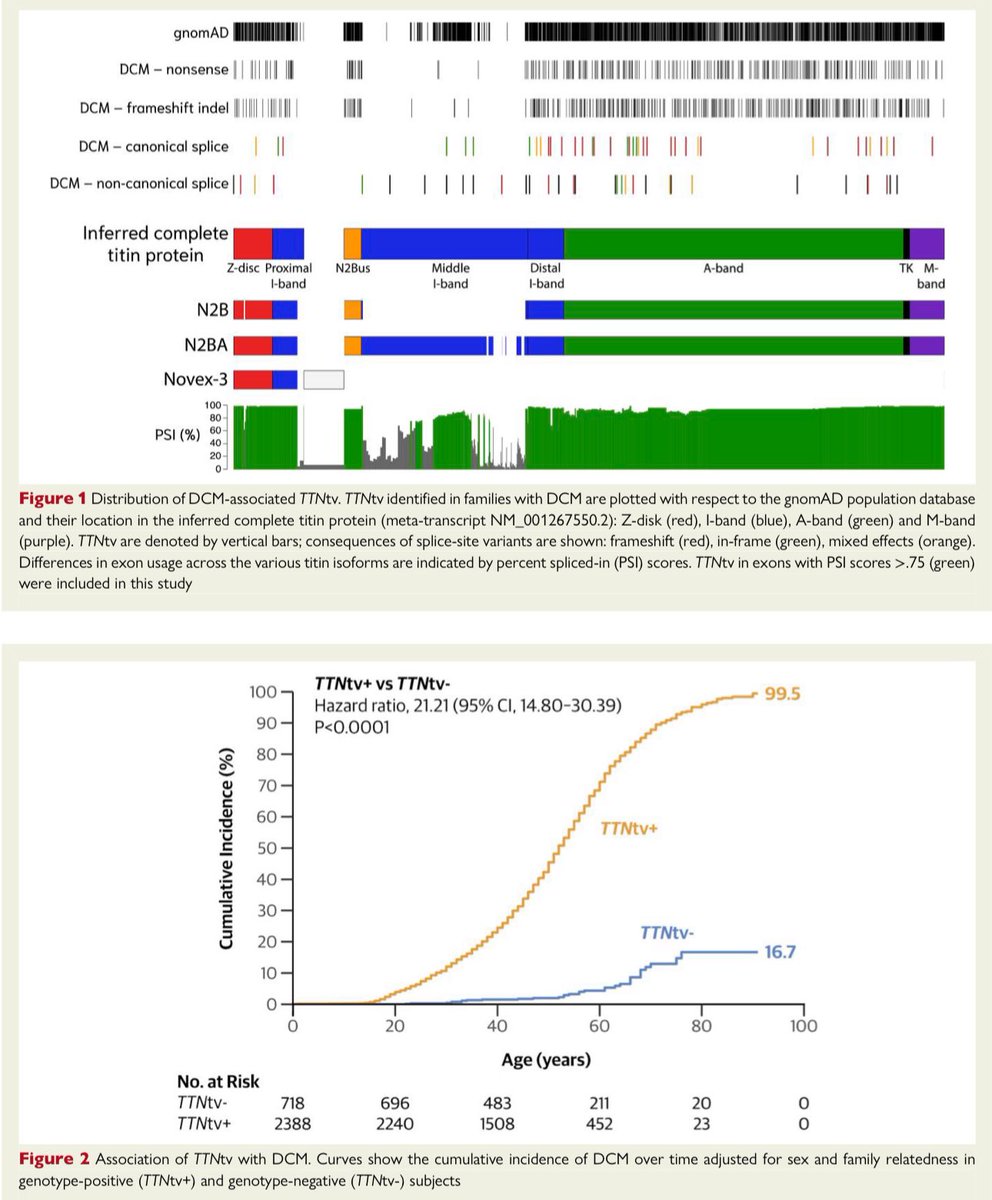 HanCardiomd's tweet photo. An international multicentre retrospective observational study on #TTNtv-related DCM (3,158 subjects, 1,043 families):

📌TTNtv carriers: 21× higher risk of #DCM.
📌Earlier onset in males.
📌Clinical risk factors ↑ odds 3.4×; #AFib doubles risk.
📌Strongest association in <30 yrs (OR 4.75).
📌Early beta-blocker or #RAS blockade ↓ risk by 87%.

https://t.co/jkjfRCM1z3

#EHJ @ehj_ed @ESC_Journals #HeartFailure