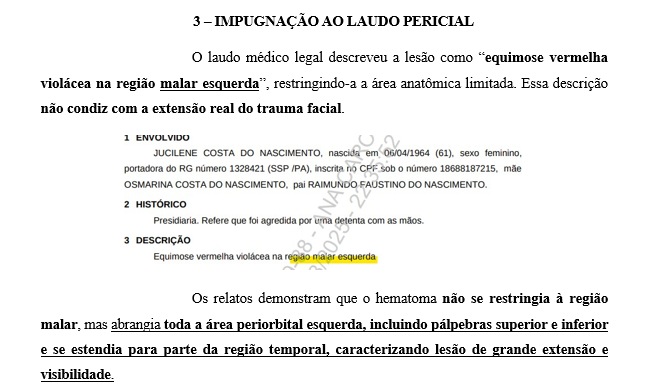 ob_porto's tweet photo. Alexandre de Moraes negou a prisão domiciliar à Sra. Jucilene (a idosa espancada no presídio).

O pior: o presídio abriu procedimento contra a advogada por um registro fotográfico da idosa.

A foto ajudou a comprovar que o laudo do presídio estava ERRADO.