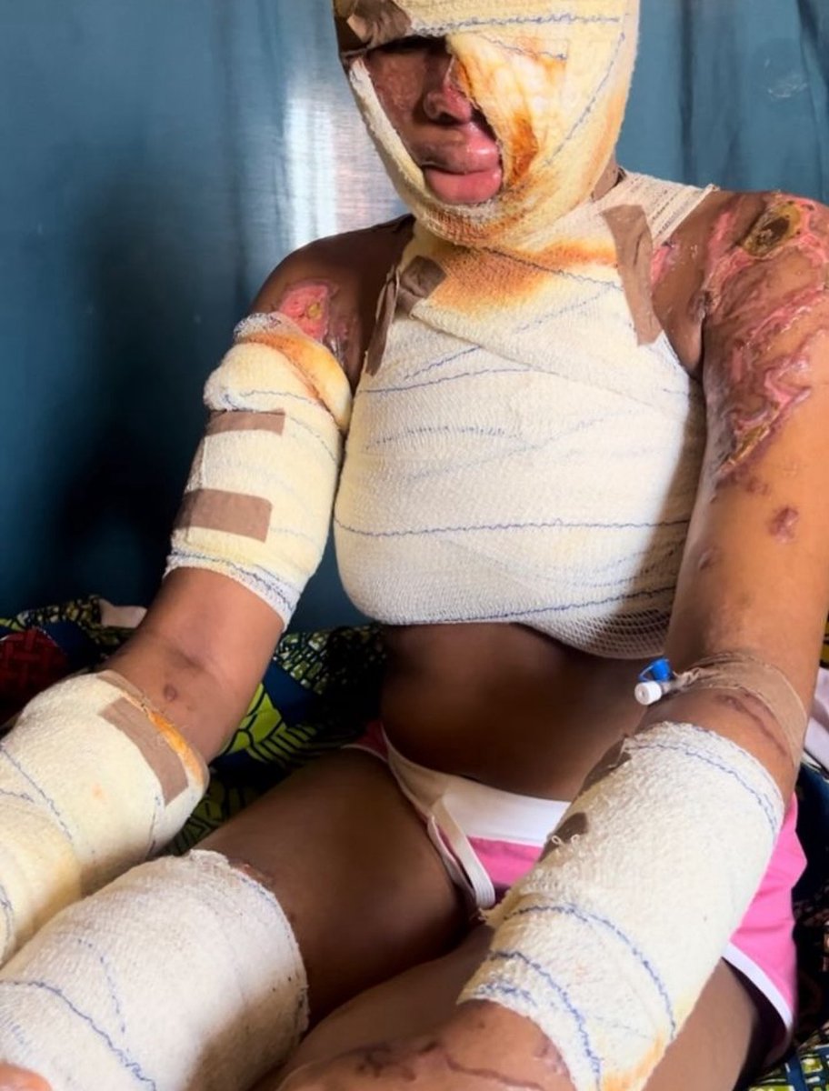 Akin Abolade (@mrlilgaga_) on Twitter photo To his Excellency, Governor <a href="/RealAARahman/">Abdulrahman Abdulrazaq</a> , please sir , one of yours in the heart of the capital city needs your help sir . Sir please come to her aid , some people says it’s impossible to raise 500,000,000 for her surgery but I know it’s possible to save her life sir To his Excellency, Governor <a href="/RealAARahman/">Abdulrahman Abdulrazaq</a> , please sir , one of yours in the heart of the capital city needs your help sir . Sir please come to her aid , some people says it’s impossible to raise 500,000,000 for her surgery but I know it’s possible to save her life sir