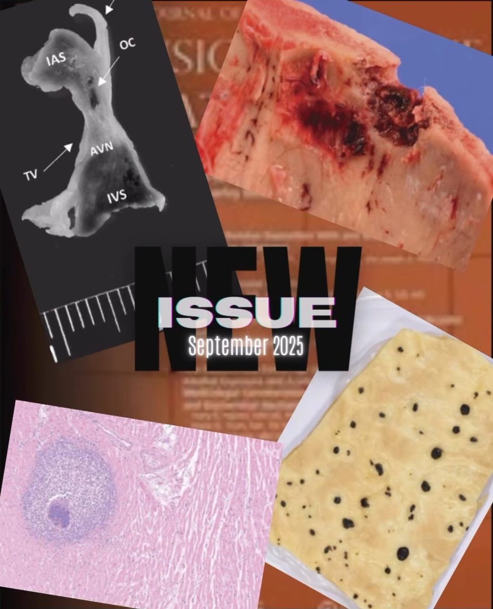 American Journal of Forensic Medicine & Pathology tweet media
