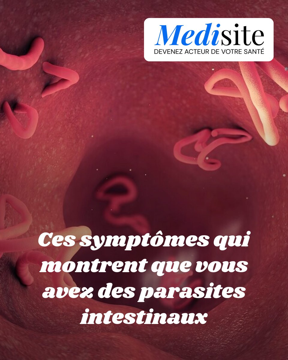 Ces symptômes qui montrent que vous avez des parasites intestinaux
➡️ l.medisite.fr/IGt