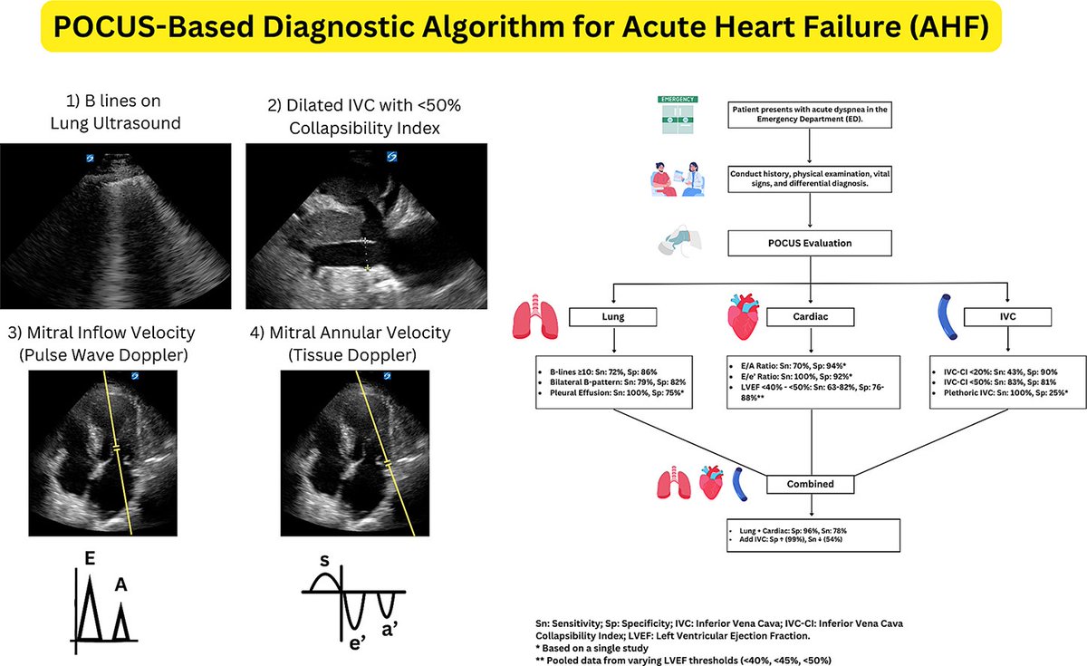 The role of #POCUS in diagnosing acute #heartfailure in the emergency department: A Meta-analysis
#FOAMed #FOAMcc #Nephpearls 
🔗 J Cardiol. 2025 Jun 22:S0914-5087(25)00165-0. doi: 10.1016/j.jjcc.2025.06.012.
