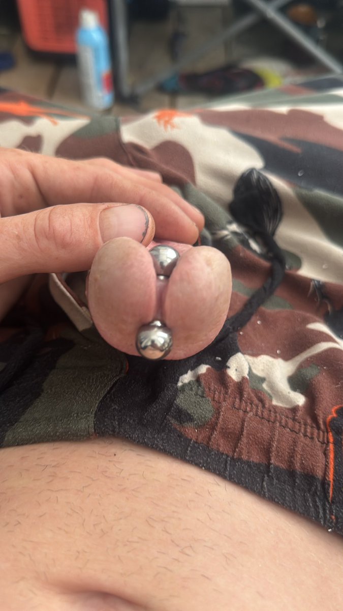 5mm RPA apadravya subincision #cockmods #cockpiercing #subincision  #apadravya #rpa