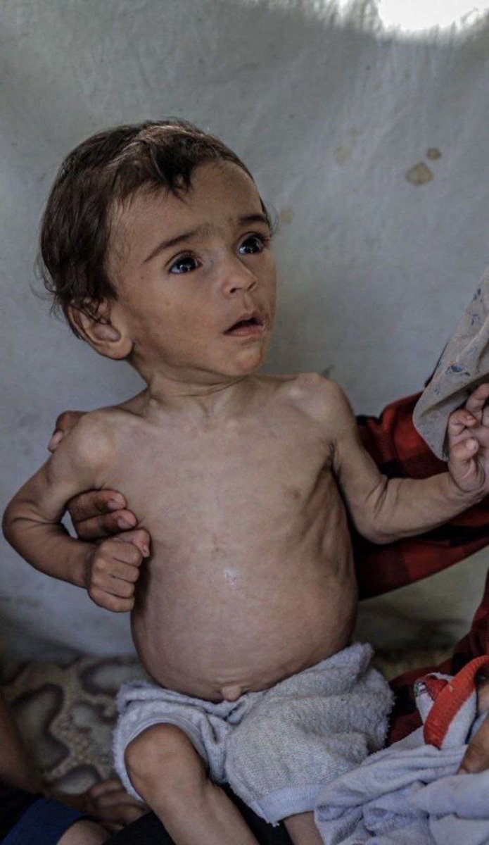 Are you still with us ? Do you hear us !
If you see this pic, LEAVE a dot. spread it 💔