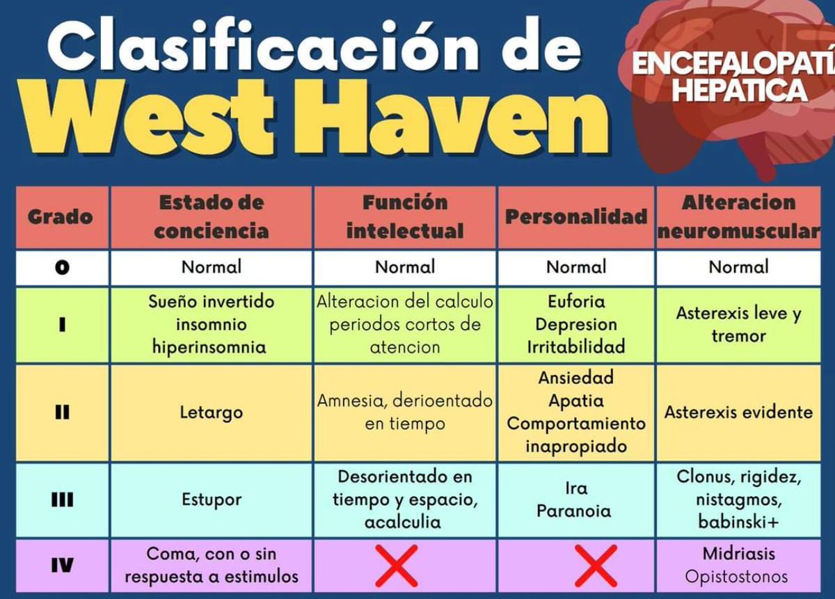 MarlonVFZR's tweet photo. 📊 𝗖𝗹𝗮𝘀𝗶𝗳𝗶𝗰𝗮𝗰𝗶𝗼́𝗻 𝗱𝗲 𝗪𝗲𝘀𝘁 𝗛𝗮𝘃𝗲𝗻 — 𝗘𝗻𝗰𝗲𝗳𝗮𝗹𝗼𝗽𝗮𝘁𝗶́𝗮 𝗛𝗲𝗽𝗮́𝘁𝗶𝗰𝗮
⬇️⬇️⬇️⬇️

𝙂𝙧𝙖𝙙𝙤 0
🧍‍♂️ Conciencia: Normal
🧠 Intelecto: Normal
🙂 Personalidad: Normal
💪 Neuromuscular: Normal

𝙂𝙧𝙖𝙙𝙤 𝙄
😴 Sueño invertido / insomnio / hipersomnia
🧮 Alteración en cálculo, ↓ atención
🙂/😠 Euforia, depresión, irritabilidad
✋ Asterexis leve, temblor

𝙂𝙧𝙖𝙙𝙤 𝙄𝙄
😌 Letargo
❓ Amnesia, desorientado en tiempo
😐 Ansiedad, apatía, conducta inapropiada
✋ Asterexis evidente

𝙂𝙧𝙖𝙙𝙤 𝙄𝙄𝙄
😵 Estupor
⏳🗺 Desorientado en tiempo y espacio, acalculia
😡 Ira, paranoia
⚡ Clonus, rigidez, nistagmo, Babinski +

𝙂𝙧𝙖𝙙𝙤 𝙄𝙑
🛌 Coma (± respuesta a estímulos)
🚫 Sin función intelectual evaluable
🚫 Sin personalidad evaluable
👀 Midriasis, opistótonos

𝘈𝘳𝘵𝘪́𝘤𝘶𝘭𝘰𝘴 𝘺 𝘮𝘢́𝘴 𝘦𝘯…
👇🏼👇🏼👇🏼👇🏼👇🏼
📑🔗🔑🔓
https://t.co/89ht2mBRSA
👉 [https://t.co/ePWvGBdde7]

#Encefalopatia #Cirrhosis #WH #ClubCrit #UCI #Emergencia #MedEd #CriticalCare #FOAMcc #FOAMed #ManejoClínico #Urgencias #UCI #Enfermería #Emergencias #ClubCrit #Medicina #UCI #FOAMed #FOAMcc #MedTwitter #ICU #POCUS #CriticalCare #MedEd #CuidadoCrítico #MedX #EducaciónMédica #MedIntensiva #MedXCommunity #MedicinaCrítica #MedED #CritCare #ICUManagement #MustRead #LecturaRecomendada
