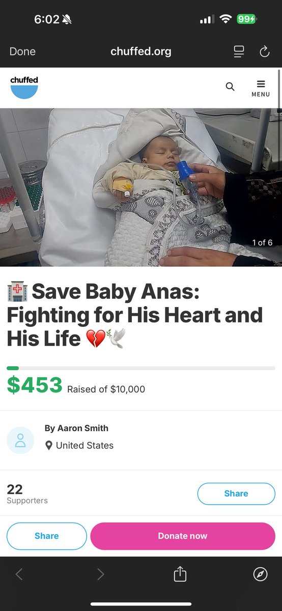 Baby Anas was starved to death by the Zionist occupation of Palestine.

Oh Ahmad, I wish you could have gotten the help you needed before it was too late. This is so deeply tragic, rest in peace Anas 😭😭😭💔💔💔💔💔💔