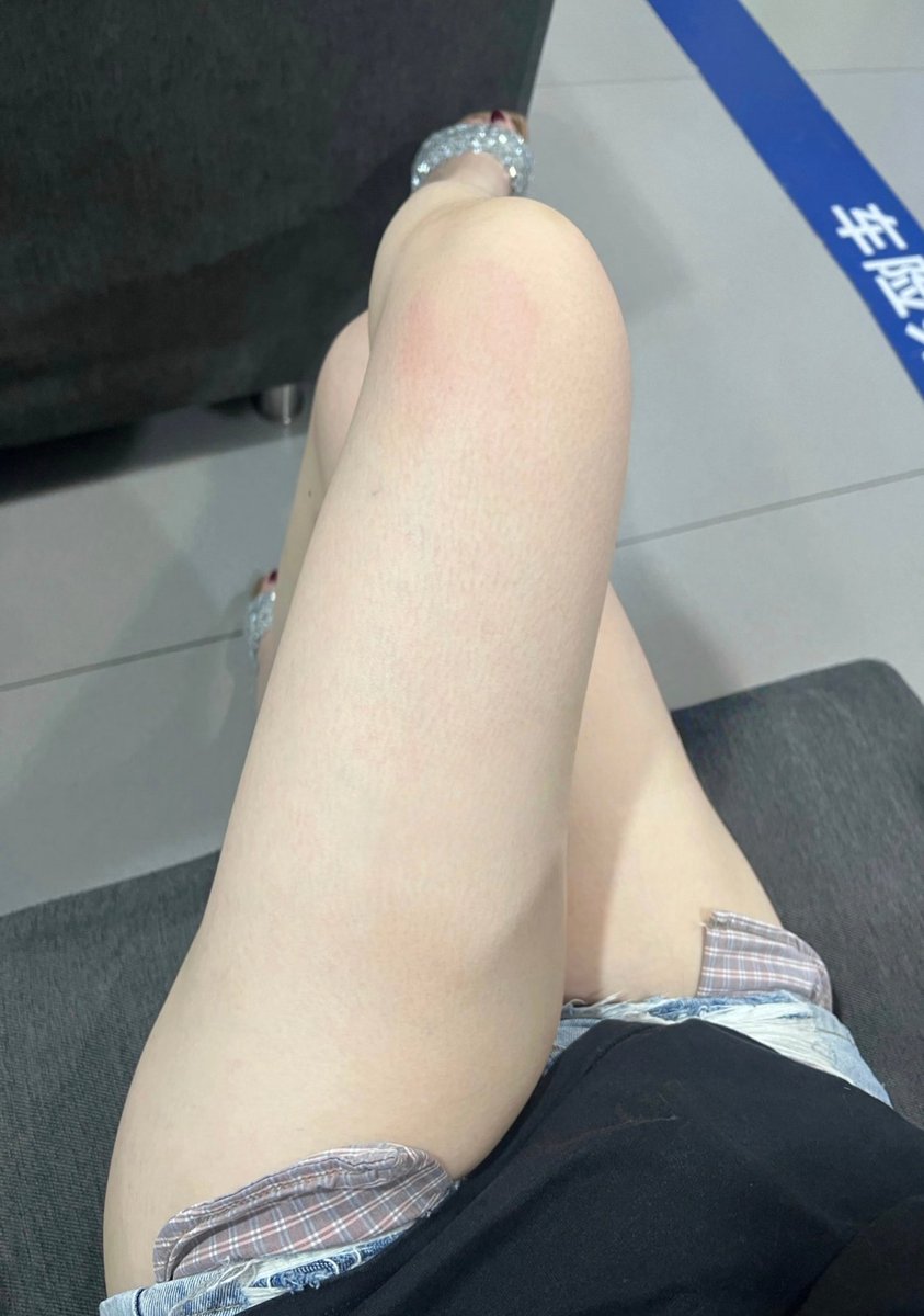 来交车险，保险业务员一点都不老实，老是偷瞄我腿，然后我把短裤往上撩了撩😳结果也还是没有给我一点点优惠 https://t.co/L4QGyWqXH0