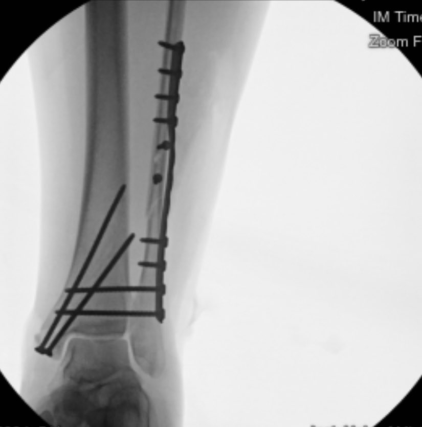 X-rays of the broken ankle because we all need to see it