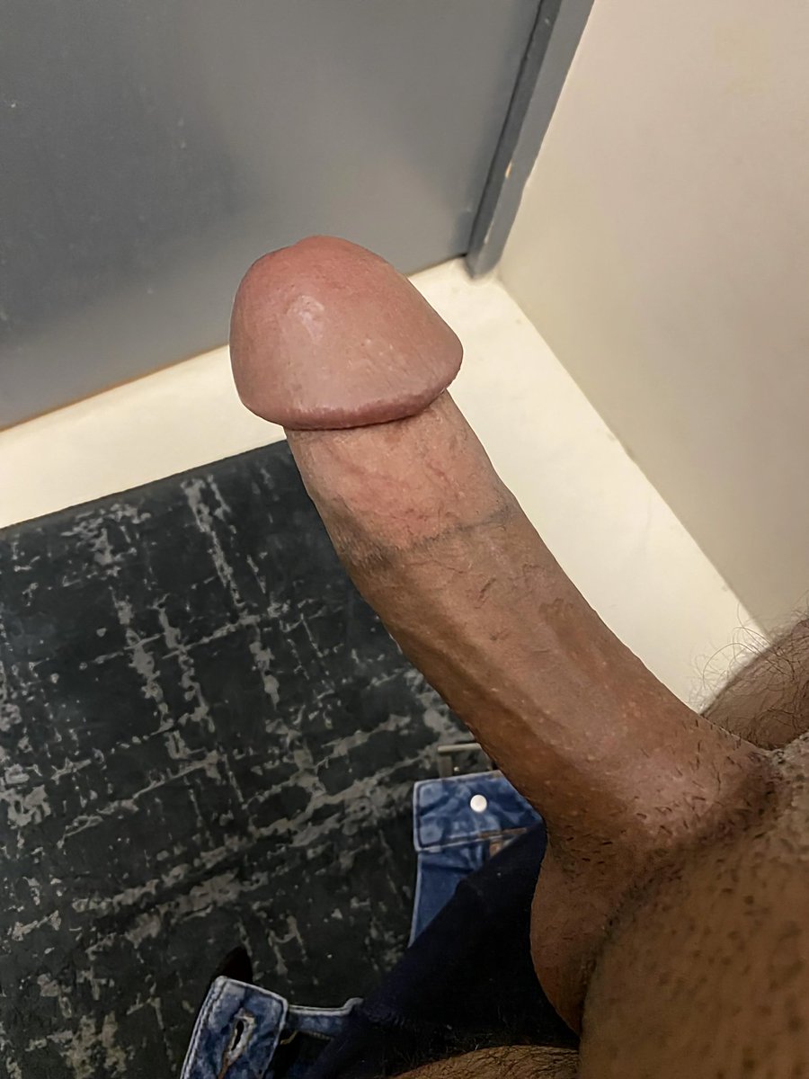 This is a solid circumcision, tight and high. An impressive, girthy mushroom glans is the cherry on top.