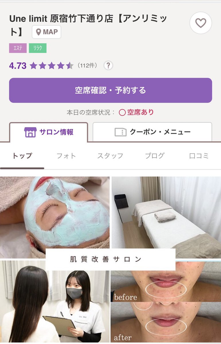 ponamiminapo's tweet photo. 日本での肌管理は@UneLimit39 でやっとります(^-^)V
前回のピーリングがめちゃくちゃ良かったから今回はスキンジェクションプロやってもらった➰🎶

施術の間にやってもらう腸マッサージが効きすぎて毎回施術後駅のトイレまで走っているﾜﾗ
体質根本からアプローチしてくれるのが良い(^-^)V https://t.co/8Yv27thflt