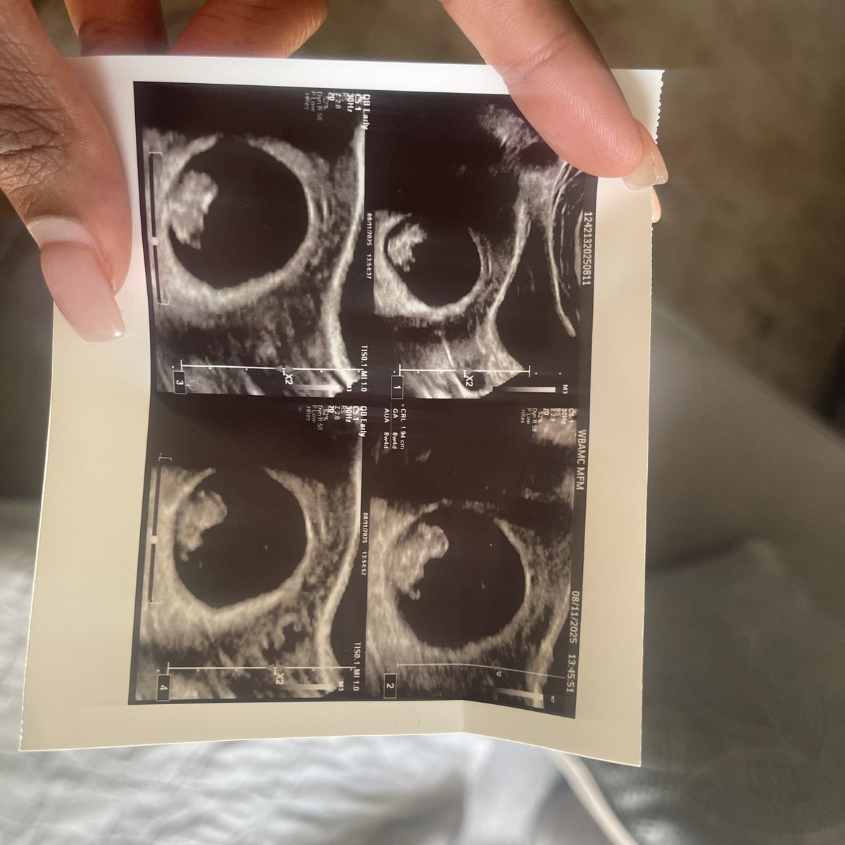 forsevyn's tweet photo. My lil beannnn🫘 posting on Twitter bc my main socials not getting it announced like this but I can’t keep holding this in 😭 good thing my twitter be dry since I’m not active anymore😝 https://t.co/9o853LdPHE