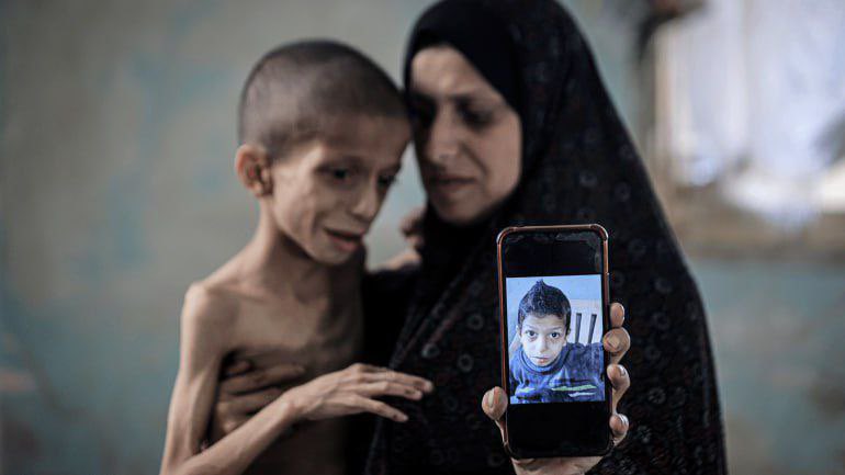 So far, 235 people have DIED due to the Israeli enforced starvation, including:
▪️106 children 
▪️129 adults 

There are 40,000 babies less than a year, and 350,000 children less than five years!