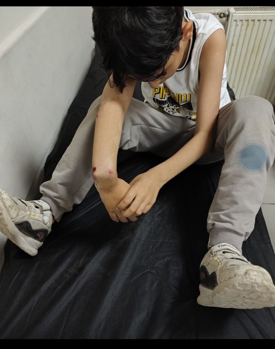 Hakkari'de bir asker, eşine bisikletle çarptığını iddia ettiği 9 yaşındaki E.T’nin kolunu kırdı. 

İHD suç duyurusunda bulundu