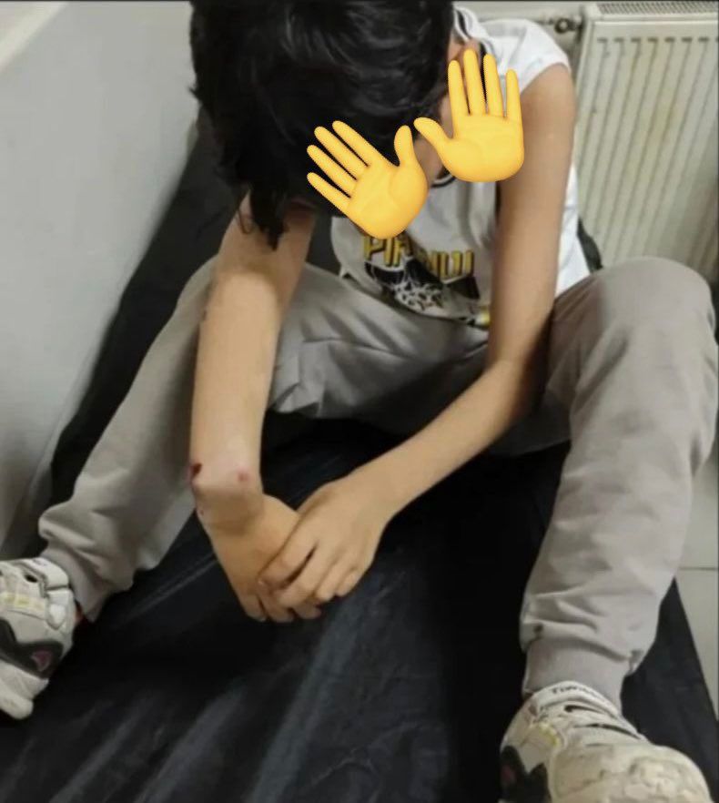 1️⃣ 13.08.2025 tarihinde, 10 yaşındaki E.T.’nin Hakkari Gençlik ve Spor İl müdürlüğü bahçesinde bisiklet sürerken bir uzman çavuşun eşine çarptığı gerekçesiyle Uzman Çavuş tarafından darp edildiği ve kolunun kırıldığı olayda gözaltına alınan uzman çavuşun bugün imza atma...