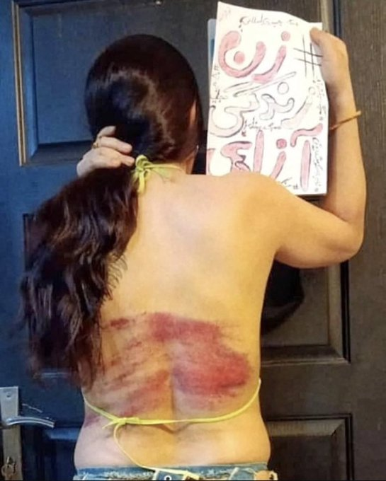 GeorgGrar's tweet photo. IRÁN🇮🇷I Una mujer muestra las heridas que sufrió en la espalda tras ser condenada a ser azotada por el régimen ISLÁMICO por desafiar las leyes del velo(hiyab).   En su mano, sostiene un papel que dice زن‌, زندگی, آزادی: “mujer, vida, libertad”. https://t.co/wbYxnXrlzp