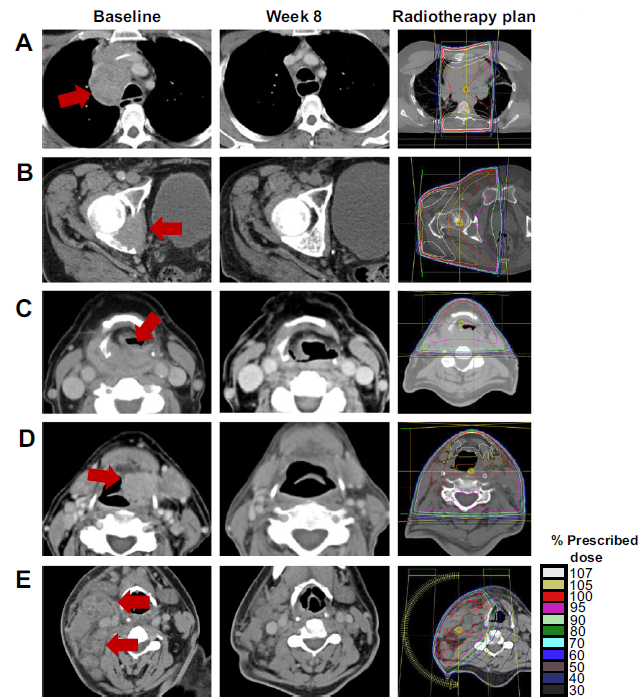 Gerry Hanna tweet media