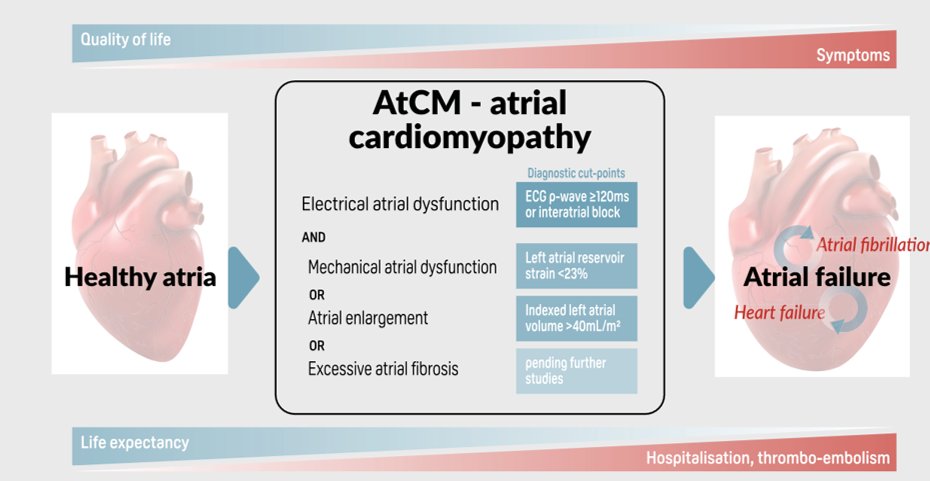 European Society of Cardiology Journals (@esc_journals) on Twitter photo Atrial cardiomyopathy: a journey from healthy atria to atrial failure. Check out the new clinical consensus statement by the #HFA #EJHF. Essential read for cardiology! #AtrialCardiomyopathy
ow.ly/2o2x50WEwbe
<a href="/EJHFEiC/">EJHF Editor-in-Chief</a> <a href="/AmrAbdin10/">Amr Abdin</a> <a href="/GiuseppeGalati_/">Giuseppe Galati</a> <a href="/HanCardiomd/">Henry Han</a> Atrial cardiomyopathy: a journey from healthy atria to atrial failure. Check out the new clinical consensus statement by the #HFA #EJHF. Essential read for cardiology! #AtrialCardiomyopathy
ow.ly/2o2x50WEwbe
<a href="/EJHFEiC/">EJHF Editor-in-Chief</a> <a href="/AmrAbdin10/">Amr Abdin</a> <a href="/GiuseppeGalati_/">Giuseppe Galati</a> <a href="/HanCardiomd/">Henry Han</a>