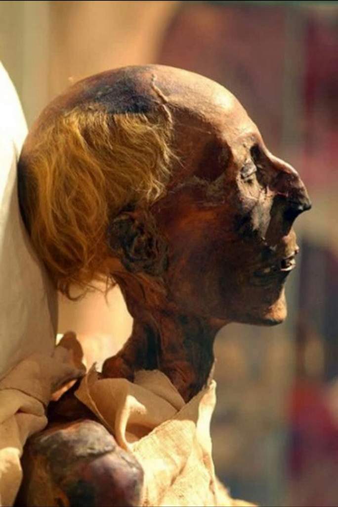 ralphyellis's tweet photo. *** Ramesses and Cleopatra were Ginger Haired ***

There are many claims swirling around the internet, that everyone in history was a black African, from the pharaohs of Egypt to the Biblical disciples. These claims are, of course, completely specious. History and science demonstrate the opposite - that many members of these ancient royal families were actually pale and ginger.

Ramesses.

For instance, the mummy of Ramesses the Great was taken to Paris for preservation, and Prof Pierre Ceccaldi of the Paris Forensic Laboratory determined he had:  Quote: Hair astonishingly preserved which showed … Ramses II was a ginger haired cymnotriche leucoderma.”  (ie:  pale skinned man with wavy ginger hair.)   See Bulletin de l’Academie de Médecine - Volume 171.  The mummy of Ramesses the Great can be seen to be ginger, in the Cairo Museum. And the forensic examination determined that this was melanin ginger, and not a hair-dye like henna.

Cleopatra.
The same is true of Queen Cleopatra, the half Macedonian queen of Egypt. Modern media, including the BBC, have portrayed Queen Cleopatra as a black lady with black hair.  Yet ancient Rome portrayed her as pale skinned and ginger.  The upper image here comes from Herculanium (Pompeii), and were likely painted within living memory of Cleopatra. The lower image was subject to modern social and political constraints.

It is not surprising that Cleopatra would be ginger.  Many of the Egyptian monarchy were ginger (as we have just seen), and many of the Greek aristocracy had 'golden hair', like Achilles, Menelaus, and Helen. Even Alexander was a rusty red-head.  So who do we believe - the lying Modern Media or the Roman Media?  Is modern society improving or deteriorating?    Images:

a.  Ramesses the Great was ginger.
b.  Forensic report on Ramesses the Great. 
c.  Frescos of Cleopatra from Herculanium. 
d. The BBC Cleopatra.  

Ralph