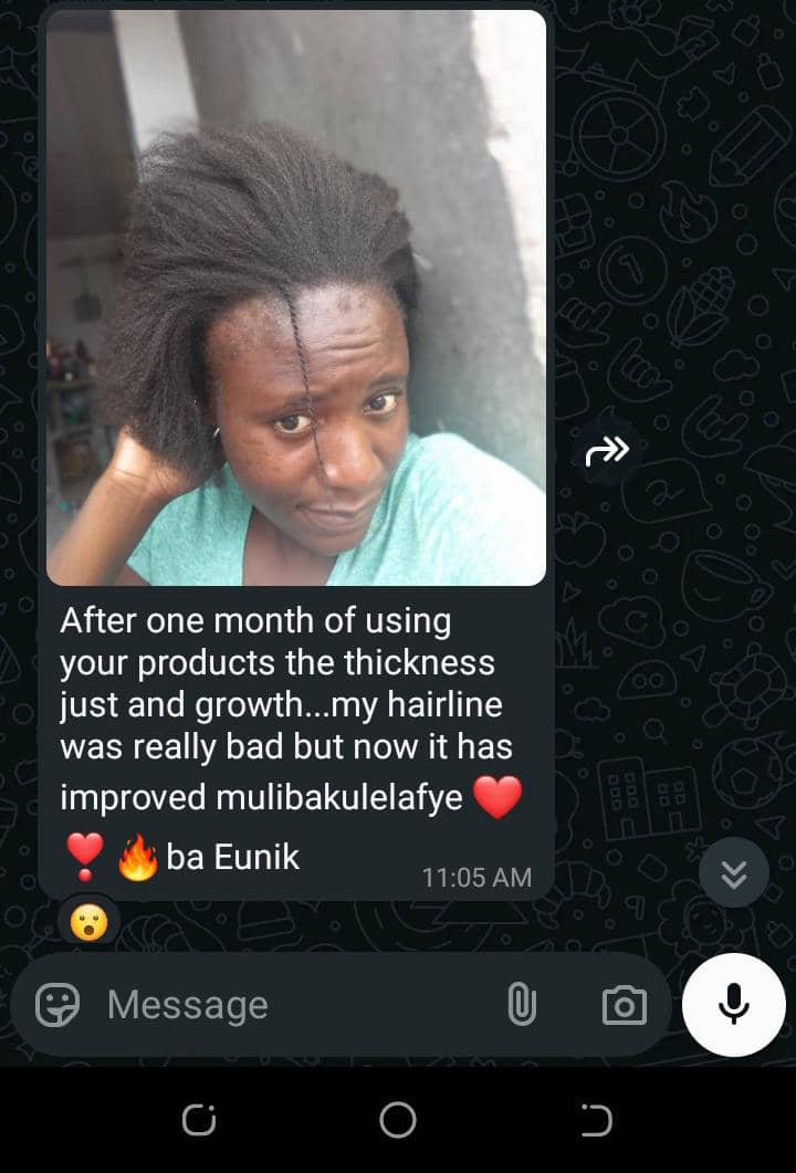 Eunikproducts's tweet image. Struggling with a thinning hairline?Reclaim your crown 👑 Your hairline deserves a comeback🌱💦Eunik Hair Products are made to restore,nourish and grow back your hairline ✨☘️
📍 Kulima tower building in katunjila road 
📱+260976028144
#HealthyEdges #RegrowthJourney #realResults