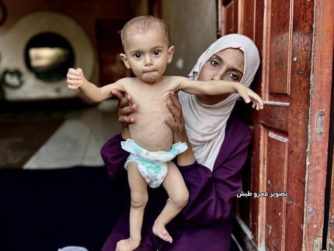 MyPalestine0's tweet photo. الطفلة الرضيعة "وتين الندى" تعبر عن جـريـمـة الجوع والخذلان https://t.co/KRwcIojNhu