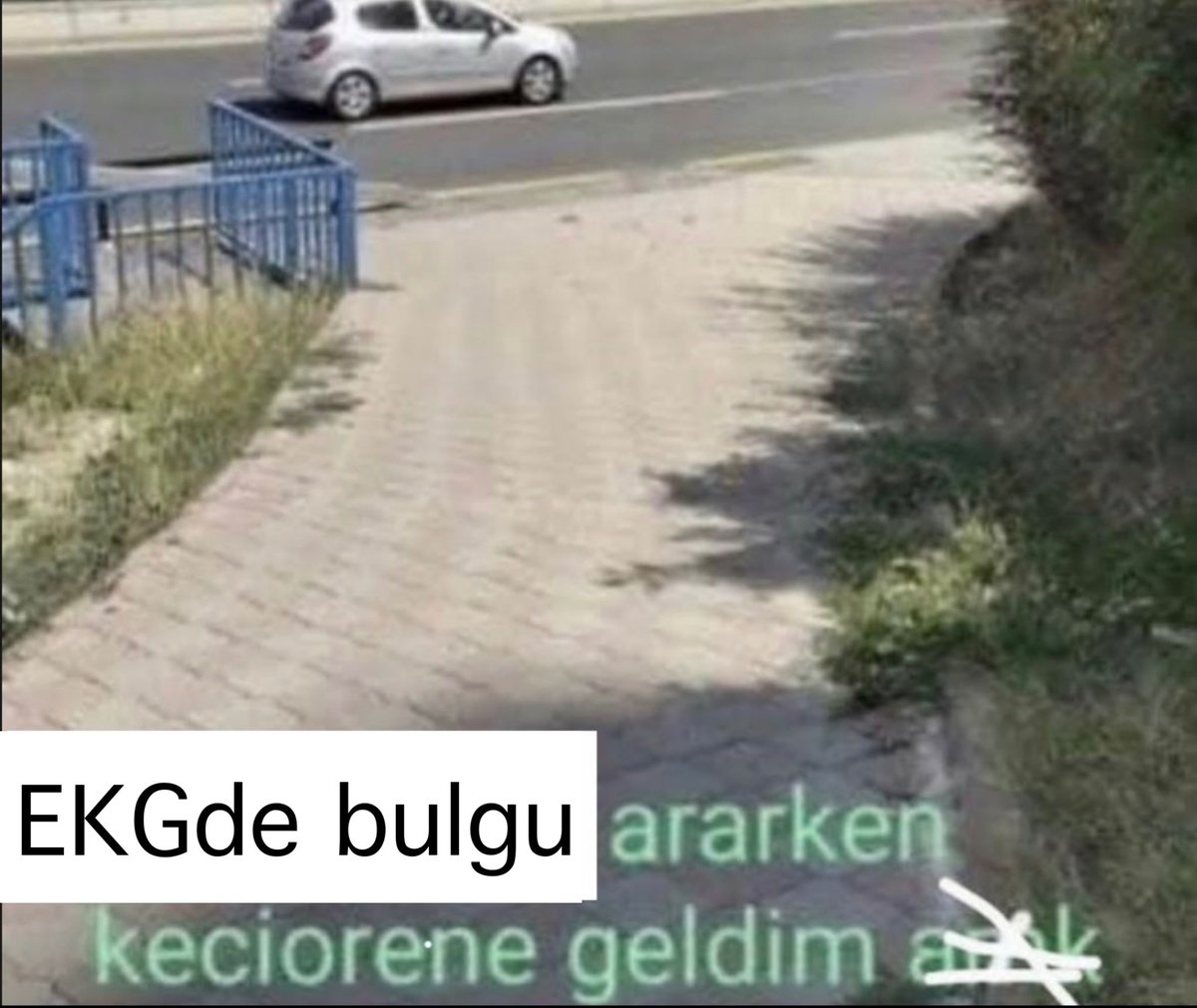 asistan abi bak şu ekgde ne goruyosun diyince