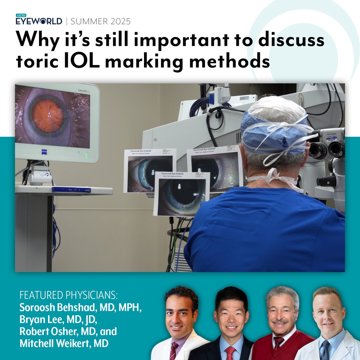 Manual vs. digital … or both—cataract surgeons have their preferences for marking the eye for toric IOL alignment. Read the pros/cons discussed by Soroosh Behshad, MD, Bryan Lee, MD, JD, Robert Osher, MD, and Mitchell Weikert, MD here bit.ly/47grFpC #EyeWorldMagazine