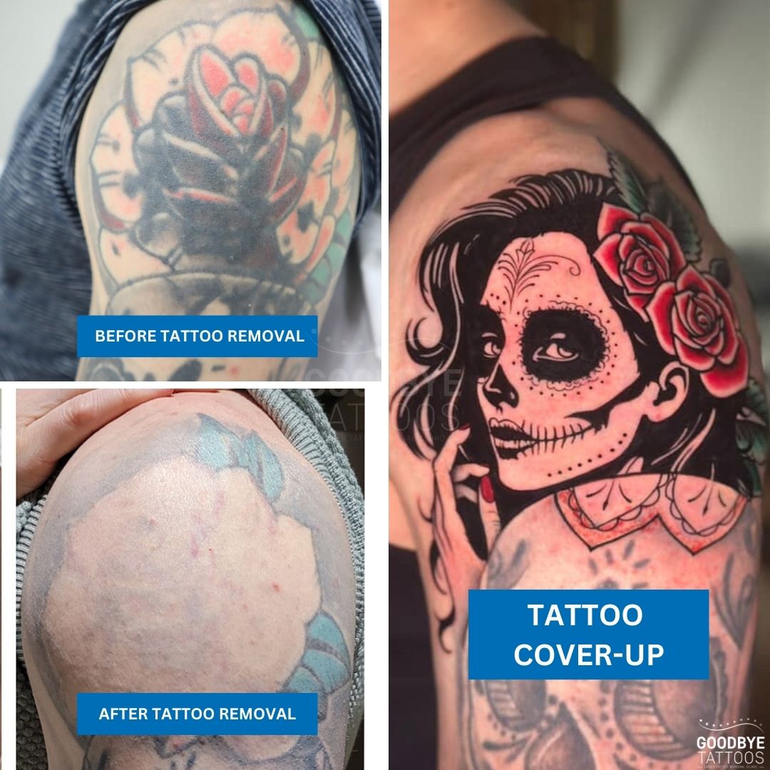 GoodbyeTattoos's tweet photo. Tattoo removal before and after....before tattoo cover-up https://t.co/HtodxSLaxK