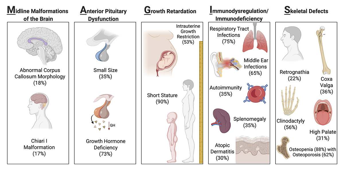 Journal of Human Immunity (@jhumimmunity) on Twitter photo Ian Lamborn, Helen Su et al. <a href="/NIAIDNews/">NIAID News</a> review MAGIS clinical features, current genetic and biochemical understanding, and future therapeutic considerations. hubs.ly/Q03CMdcG0
#ClinicalPhenotypes #InbornErrorsOfImmunity #Diagnostics Ian Lamborn, Helen Su et al. <a href="/NIAIDNews/">NIAID News</a> review MAGIS clinical features, current genetic and biochemical understanding, and future therapeutic considerations. hubs.ly/Q03CMdcG0
#ClinicalPhenotypes #InbornErrorsOfImmunity #Diagnostics