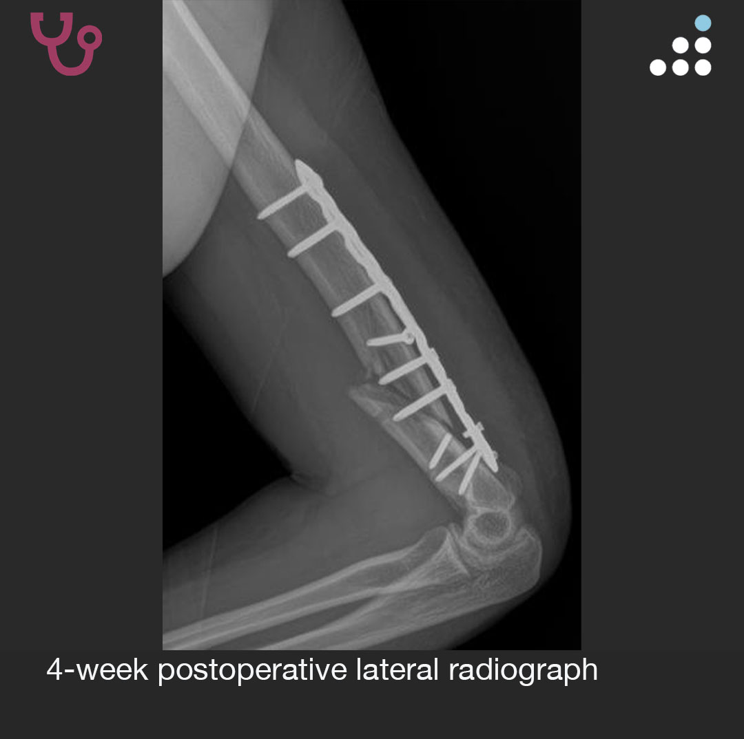 Orthobullets tweet media