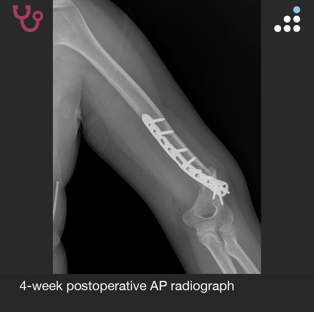 Orthobullets tweet media