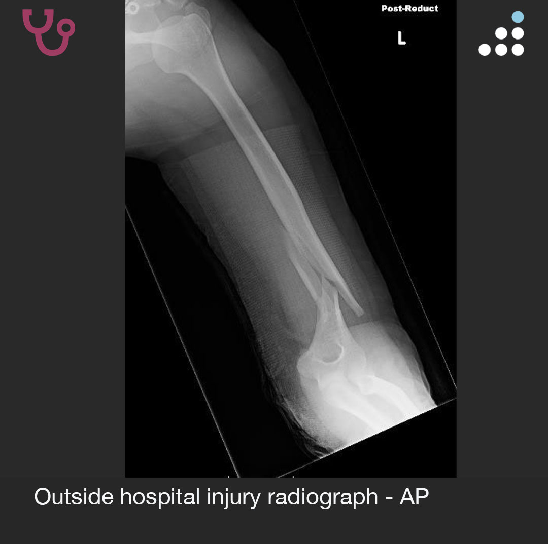 Orthobullets tweet media