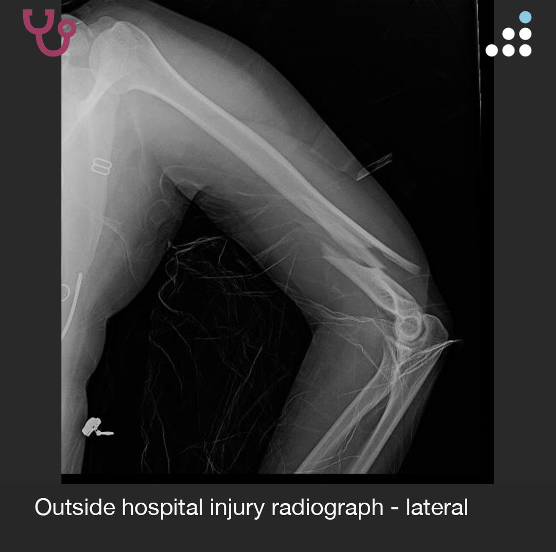 Orthobullets tweet media