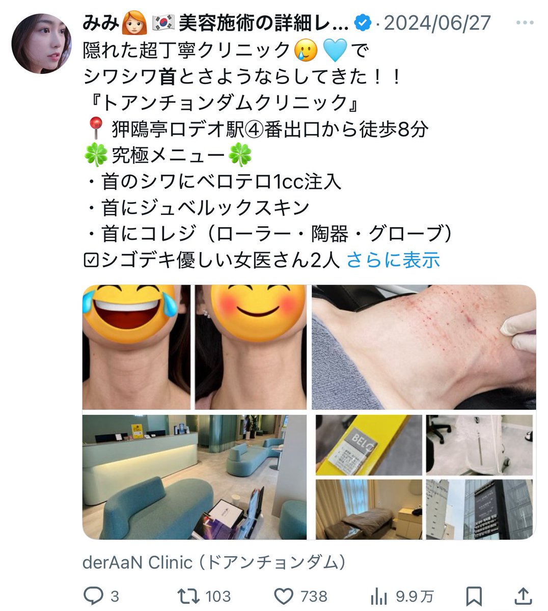 mimi___ooo33's tweet photo. 私が本気でお勧めする韓国のクリニック４選
（お財布に優しくない編）

身をもって「素晴らしい！お金が続くなら通いたい！」と感動したクリニックたち。

①ドアンチョンダム
②リプトン
③ポイントアップ
④フォルテ

高額だしそれなら日本でって思うかもしれないけど、丁寧すぎるドクター施術＆スパルタ治療で効果半端ないよ🖐️