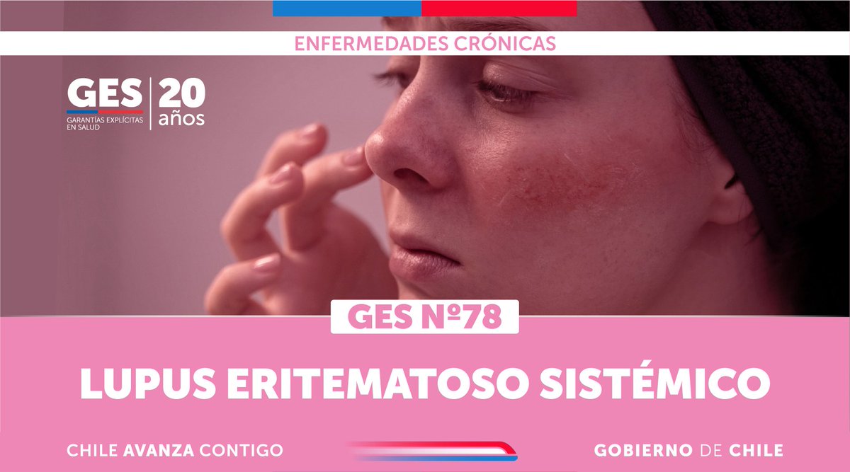 ministeriosalud's tweet image. #GES78 Toda persona que tenga confirmación de Lupus Eritematoso Sistémico, enfermedad donde el sistema inmunitario ataca células y tejidos sanos por error, podrá acceder a cobertura #GES.

Encuentra más información en auge.minsal.cl o llamando a Salud Responde 600 360…