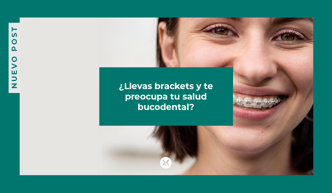 Llevar brackets requiere una serie de cuidados específicos para mantener una sonrisa sana. 🦷 Con una rutina de higiene completa y productos adecuados, puedes evitar las manchas y proteger el esmalte.   💙 bit.ly/4mol0hs 
#LaboratoriosKIN #OrthoKIN #Brackets