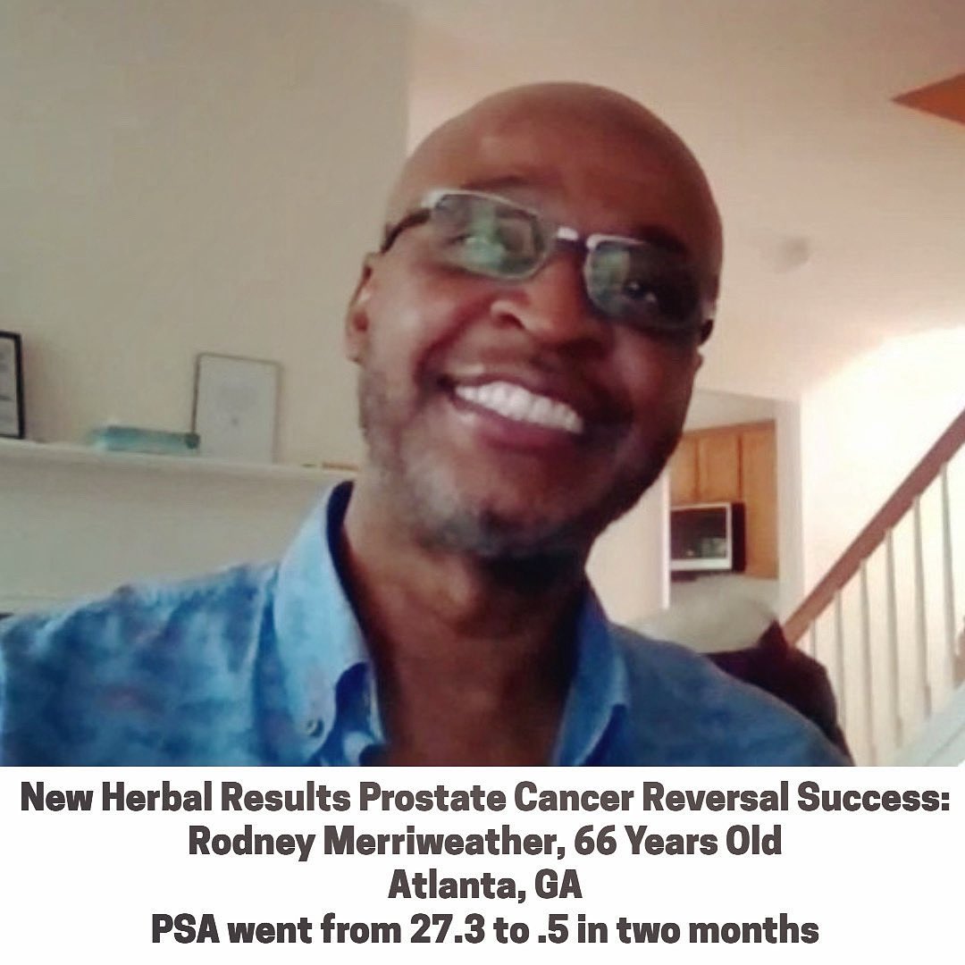 His doctors are speechless. They were wrong and now they are embarrassed. Under the care of his Oncologists and Urologists, his PSA rose from 14 to 27.3. He refused to do any more of their chemotherapy, radiation and surgeries, then contacted me after my April 12, 2025 lecture in