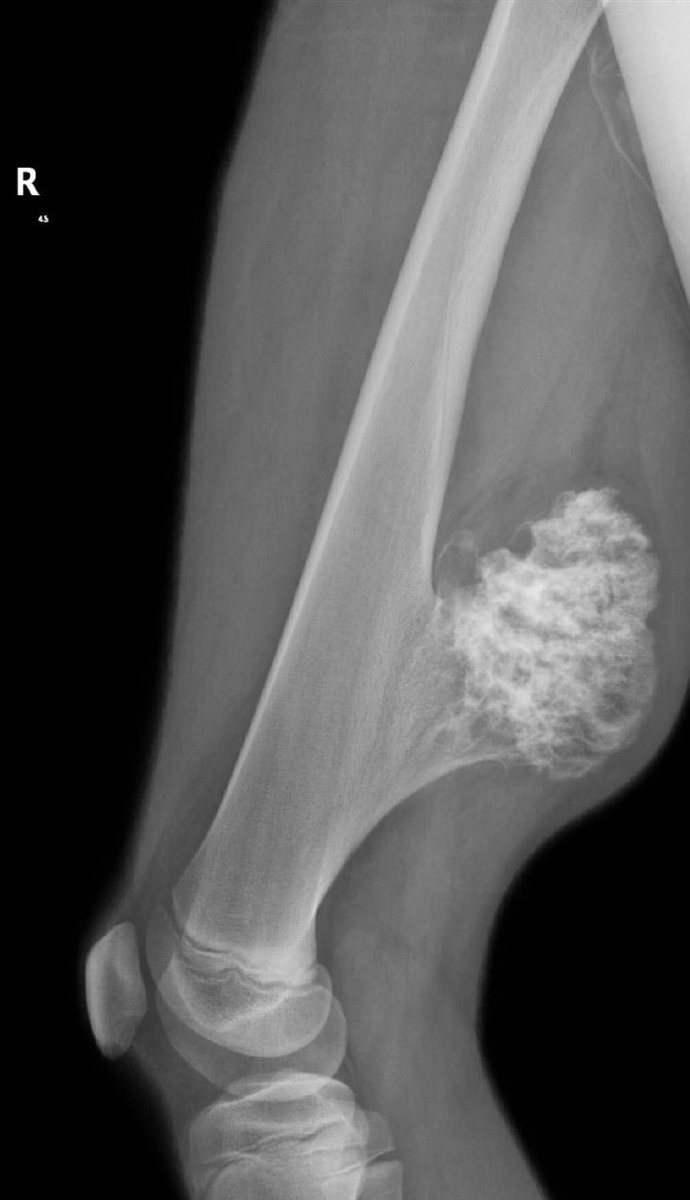 IhabFathiSulima's tweet photo. What is the diagnosis? https://t.co/N8Sw9AYIZa