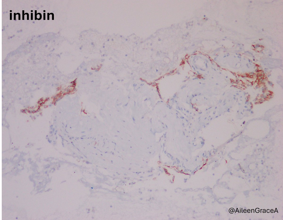 CooperPathology tweet media