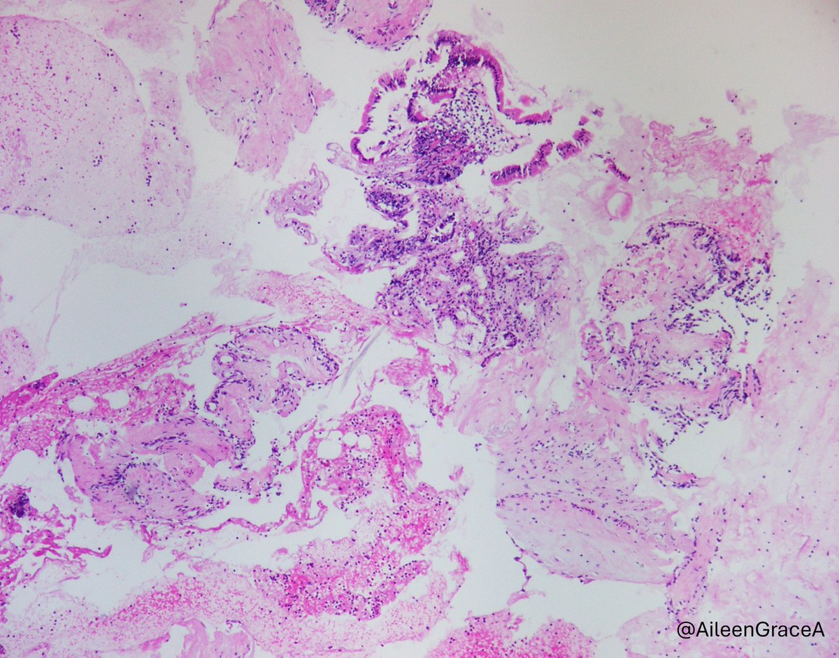 CooperPathology tweet media