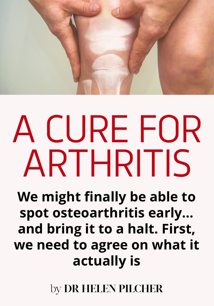 Plenty of new treatments on the horizon for osteoarthritis, especially if you're a gorilla called Liesel from Budapest Zoo. For <a href="/sciencefocus/">BBC Science Focus Magazine</a> and <a href="/AppleNews/">Apple News</a> apple.news/APYpMDbtRRMuzO…  Link also in linktree link in bio.